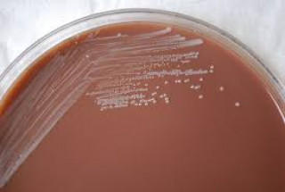Deadly Bacteria Leaks From Factory : Over 3,000 People In China Infected