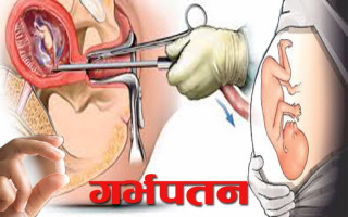 पूर्वराजकुमार पत्नीको गर्भपात भएको खुलासा