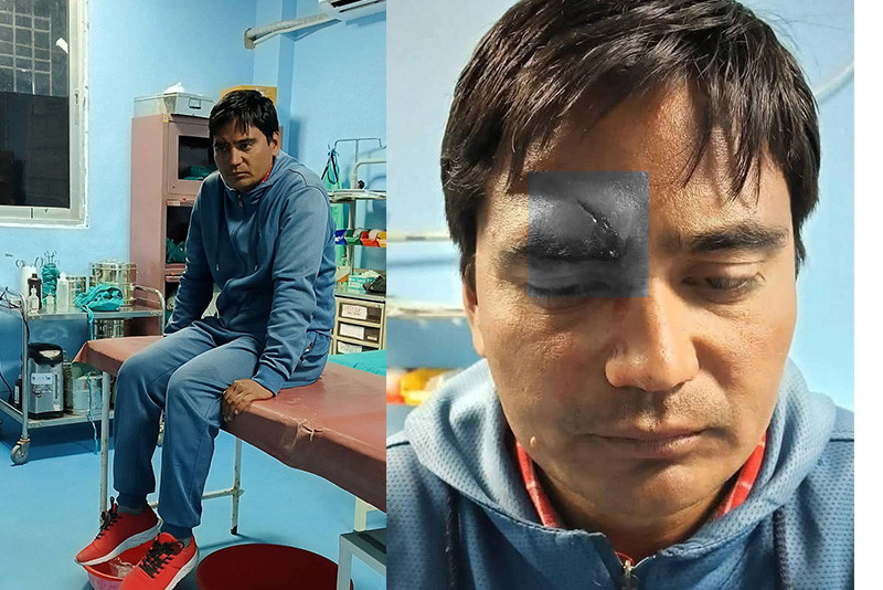 पत्रकार महासंघ बझाङका अध्यक्ष ललित सिंह माथि चक्कु प्रहार